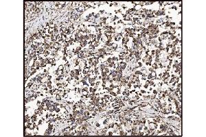 IHC analysis of FABP-1/GOT2 using anti-FABP-1/GOT2 antibody (ABIN7601426). (GOT2 antibody  (AA 35-430))