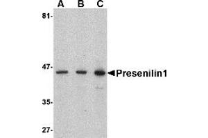 Western Blotting (WB) image for anti-Presenilin 1 (PSEN1) (C-Term) antibody (ABIN1030600) (Presenilin 1 antibody  (C-Term))