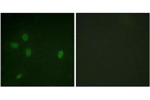 Immunofluorescence analysis of NIH/3T3 cells, using 53BP1 (Phospho-Ser25) antibody.