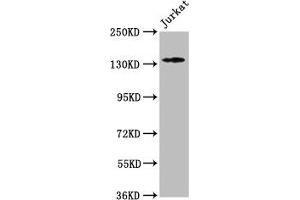 Western Blot Positive WB detected in: Jurkat whole cell lysate All lanes: ATP2B3 antibody at 1:500 Secondary Goat polyclonal to rabbit IgG at 1/50000 dilution Predicted band size: 135, 129, 128, 133, 127, 125, 123 kDa Observed band size: 135 kDa (ATP2B3 antibody  (AA 1057-1220))