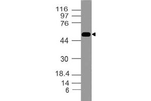 Image no. 1 for anti-Tumor Necrosis Factor Receptor Superfamily, Member 10a (TNFRSF10A) (AA 2-203) antibody (ABIN5027280) (TNFRSF10A antibody  (AA 2-203))