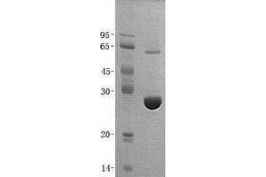 Validation with Western Blot (UROS Protein (His tag))