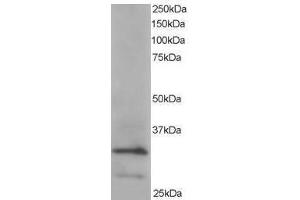 Image no. 1 for anti-Actin Related Protein 2/3 Complex, Subunit 2, 34kDa (ARPC2) (C-Term) antibody (ABIN374215) (ARPC2 antibody  (C-Term))