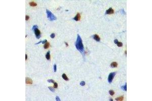 Immunohistochemical analysis of RING1b staining in mouse brain formalin fixed paraffin embedded tissue section. (RNF2 antibody)