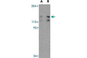 Western blot analysis of FYB in K-562 cell lysate with FYB polyclonal antibody  at (A) 0.