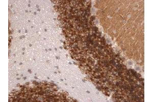 Immunohistochemistry (IHC) image for anti-Potassium Voltage-Gated Channel, Shal-Related Subfamily, Member 2 (KCND2) (Extracellular Domain) antibody (ABIN6658239)