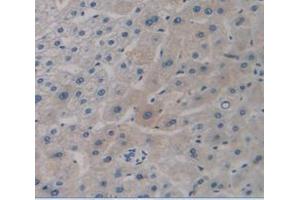 IHC-P analysis of Human Tissue, with DAB staining. (Transferrin antibody  (AA 361-683))