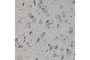 Immunohistochemistry of paraffin-embedded rat brain using UQCRC1 antibody. (UQCRC1 antibody  (AA 156-480))