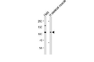 Western blot analysis of lysates from Hela cell line and human skeletal muscle tissue (from left to right), using DNMT3A Antibody (Center) (ABIN6243165 and ABIN6577841). (DNMT3A antibody  (AA 463-497))