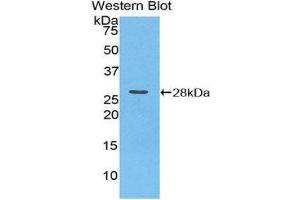 Western Blotting (WB) image for anti-Calcium Independent Phospholipase A2 (PNPLA2) (AA 481-702) antibody (ABIN1859464) (PNPLA2 antibody  (AA 481-702))