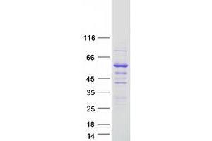 Western Blotting (WB) image for Syntrophin, beta 2 (Dystrophin-Associated Protein A1, 59kDa, Basic Component 2) (SNTB2) protein (Myc-DYKDDDDK Tag) (ABIN2733133)