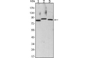 Western blot analysis using CHUK mouse mAb against Raji (1), Jurkat (2) and THP-1 (3) cell lysate. (IKK alpha antibody)
