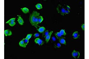 Immunofluorescent analysis of MCF-7 cells using ABIN7177361 at dilution of 1:100 and Alexa Fluor 488-congugated AffiniPure Goat Anti-Rabbit IgG(H+L) (IDH1 antibody  (AA 1-240))