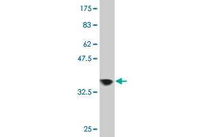 Western Blot detection against Immunogen (37. (ZNF274 antibody  (AA 420-530))