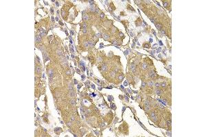 Immunohistochemistry of paraffin-embedded human stomach using RASGRF1 antibody at dilution of 1:100 (x400 lens). (RASGRF1 antibody)