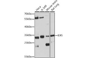Western blot analysis of extracts of various cell lines, using IER5 Rabbit pAb (ABIN7267843) at 1:1000 dilution.