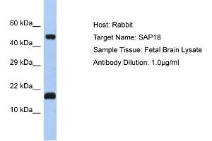 Host: Rabbit Target Name: SAP18 Sample Tissue: Human Fetal Brain Antibody Dilution: 1ug/ml (SAP18 antibody  (N-Term))