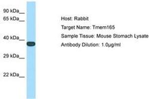 Image no. 1 for anti-Transmembrane Protein 165 (TMEM165) (N-Term) antibody (ABIN6749912) (TMEM165 antibody  (N-Term))