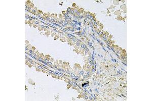 Immunohistochemistry of paraffin-embedded human prostate using PPIC antibody at dilution of 1:100 (x40 lens). (PPIC antibody)