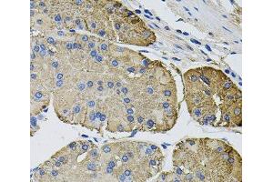 Immunohistochemistry of paraffin-embedded Human stomach using THBS2 Polyclonal Antibody at dilution of 1:100 (40x lens). (Thrombospondin 2 antibody)