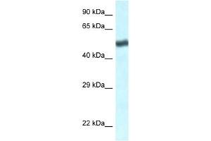 Western Blot showing TBL1XR1 antibody used at a concentration of 1 ug/ml against Jurkat Cell Lysate (TBL1XR1 antibody  (C-Term))