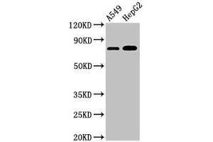Western Blot Positive WB detected in: A549 whole cell lysate, HepG2 whole cell lysate All lanes: TBC1D15 antibody at 3 μg/mL Secondary Goat polyclonal to rabbit IgG at 1/50000 dilution Predicted band size: 80, 78, 79 kDa Observed band size: 80 kDa (TBC1D15 antibody  (AA 283-404))
