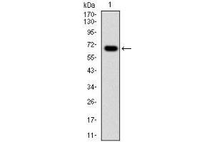 Western blot analysis using G6PD mAb against human G6PD (AA: 275-515) recombinant protein. (Glucose-6-Phosphate Dehydrogenase antibody)