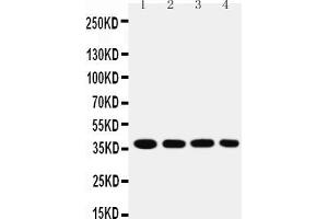 Anti-MTCO1 antibody, Western blotting Lane 1: SMMC Cell Lysate Lane 2: MCF-7 Cell Lysate Lane 3: RAJI Cell Lysate Lane 4: SW620 Cell Lysate (COX1 antibody  (C-Term))