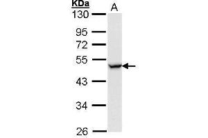 WB Image Sample (30 ug of whole cell lysate) A: Hela 10% SDS PAGE antibody diluted at 1:1000 (CCR8 antibody  (Center))