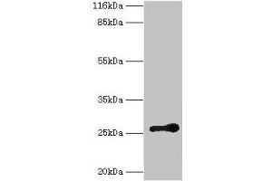Western blot All lanes: RAB3C antibody at 2 μg/mL + Mouse brain tissue Secondary Goat polyclonal to rabbit IgG at 1/10000 dilution Predicted band size: 26 kDa Observed band size: 26 kDa (Rab3c antibody  (AA 1-227))