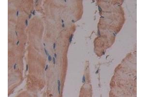 Detection of GLUD1 in Mouse Skeletal muscle Tissue using Polyclonal Antibody to Glutamate Dehydrogenase 1 (GLUD1) (GLUD1 antibody  (AA 65-273))