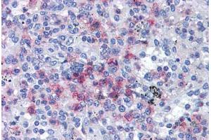 Immunohistochemistry (Formalin-fixed Paraffin-embedded Sections) (IHC (fp)) image for anti-Spleen Focus Forming Virus (SFFV) Proviral Integration Oncogene Spi1 (SPI1) (AA 1-122) antibody (ABIN574131)