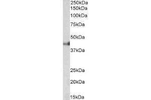 ABIN4902686 (0. (Cytokeratin 18 antibody)