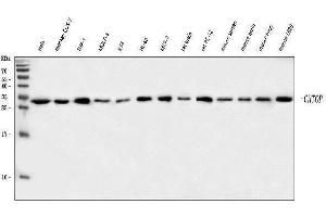 Western blot analysis of C1orf77/FOP/CHTOP using anti-C1orf77/FOP/CHTOP antibody (ABIN7603201).