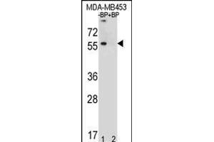 Western blot analysis of TOX3 Antibody (Center) Pab (ABIN651009 and ABIN2840037) pre-incubated without(lane 1) and with(lane 2) blocking peptide in MDA-M cell line lysate. (TOX3 antibody  (AA 214-242))