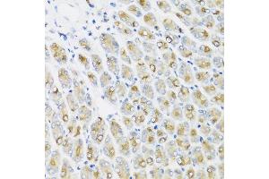Immunohistochemistry of paraffin-embedded mouse stomach using IFNL1 antibody at dilution of 1:100 (40x lens).
