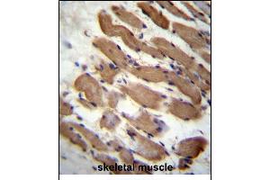 LMD Antibody (N-term) (ABIN657125 and ABIN2846269) immunohistochemistry analysis in formalin fixed and raffin embedded human skeletal muscle followed by peroxidase conjugation of the secondary antibody and DAB staining. (PALMD antibody  (N-Term))