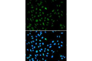 Immunofluorescence analysis of A549 cell using EZH1 antibody.
