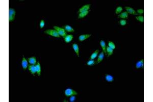Immunofluorescent analysis of HepG2 cells using ABIN7153811 at dilution of 1:100 and Alexa Fluor 488-congugated AffiniPure Goat Anti-Rabbit IgG(H+L) (USO1 antibody  (AA 591-733))