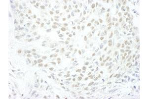anti-MLLT1, super elongation complex subunit (MLLT1) (AA 325-375) antibody