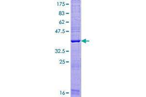 Transmembrane Protein 88 (TMEM88) (AA 1-159) protein (GST tag)