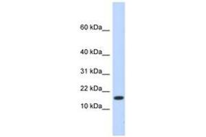 Image no. 1 for anti-Hect Domain and RLD 4 (HERC4) (N-Term) antibody (ABIN6743142) (HERC4 antibody  (N-Term))
