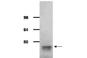 Image no. 1 for anti-Aldolase A, Fructose-Bisphosphate (ALDOA) antibody (ABIN799723) (ALDOA antibody)