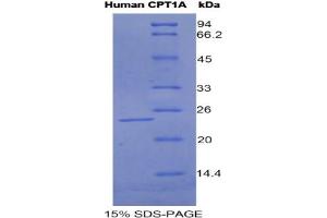 SDS-PAGE analysis of Human CPT1A Protein. (CPT1A Protein)