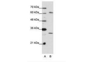 Image no. 2 for anti-AU RNA Binding Protein/enoyl-CoA Hydratase (AUH) (AA 228-277) antibody (ABIN6736199) (AUH antibody  (AA 228-277))