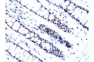 Immunohistochemistry of paraffin-embedded human colon using MCM5 Rabbit mAb (ABIN7268543) at dilution of 1:100 (40x lens). (MCM5 antibody)
