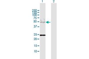 Western Blot analysis of KRT8 expression in transfected 293T cell line by KRT8 MaxPab polyclonal antibody. (KRT8 antibody  (AA 1-483))