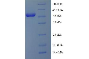 SDS-PAGE (SDS) image for Unc-51 Like Kinase 1 (ULK1) (AA 11-312) protein (His-SUMO Tag) (ABIN5711431) (ULK1 Protein (AA 11-312) (His-SUMO Tag))