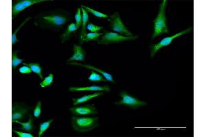 Immunofluorescence of purified MaxPab antibody to SERPINF2 on HeLa cell. (alpha 2 Antiplasmin antibody  (AA 1-491))