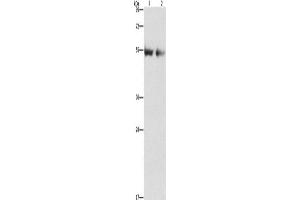 Western Blotting (WB) image for anti-Angiopoietin 4 (ANGPT4) antibody (ABIN2432478) (Angiopoietin 4 antibody)